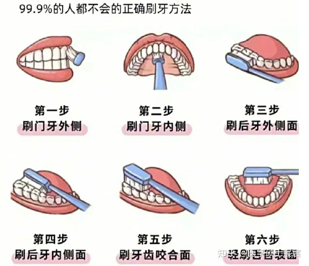 电动牙刷要紧贴牙齿吗？解读正确刷牙方法与技巧